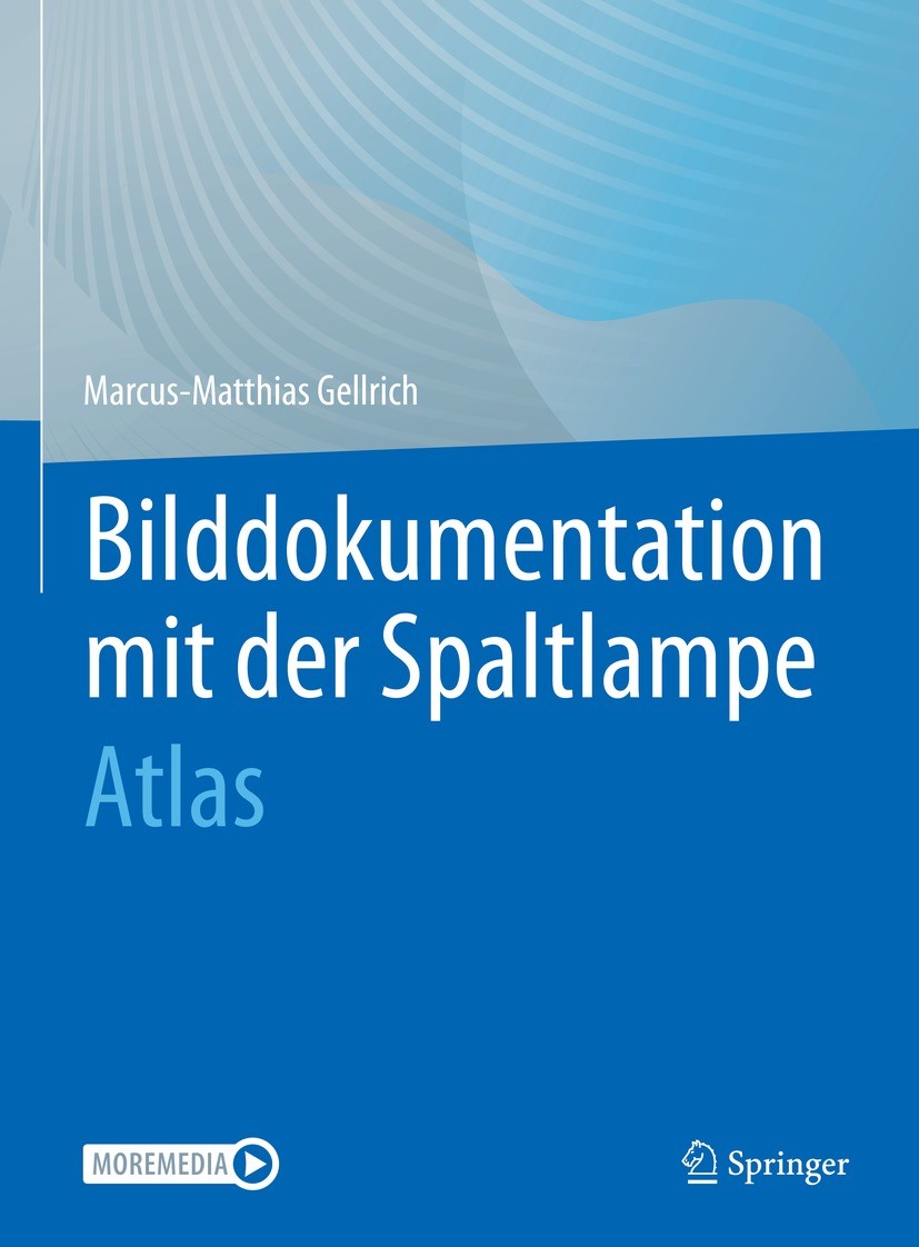 Titlebook: Bilddokumentation mit der Spaltlampe; Atlas Marcus-Matthias Gellrich Book 2023 Der/die Herausgeber bzw. der/die Autor(en), exklusiv lizenzi Titlebook: Bilddokumentation mit der Spaltlampe; Atlas Marcus-Matthias Gellrich Book 2023 Der/die Herausgeber bzw. der/die Autor(en), exklusiv lizenzi