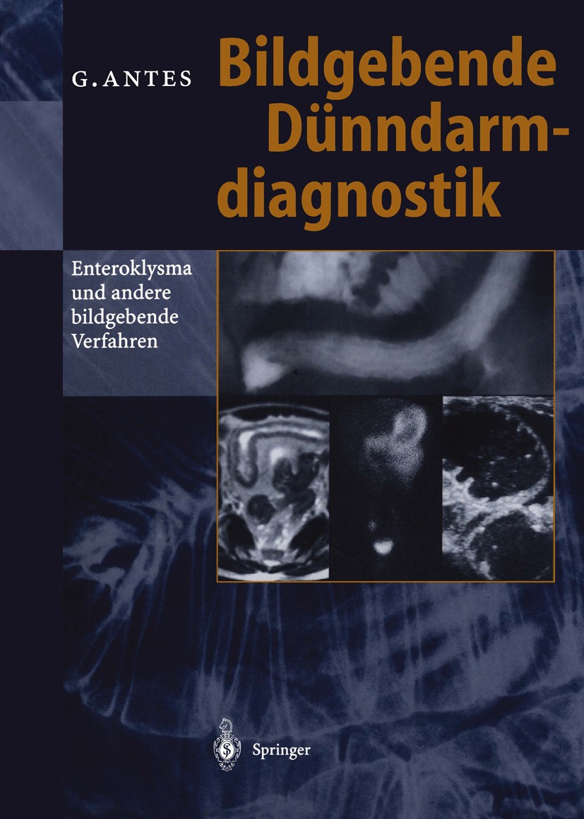 Titlebook: Bildgebende Dünndarmdiagnostik; Enteroklysma und and Günther Antes Book 1998 Springer-Verlag Berlin Heidelberg 1998 Bariumuntersuchung.Comp Titlebook: Bildgebende Dünndarmdiagnostik; Enteroklysma und and Günther Antes Book 1998 Springer-Verlag Berlin Heidelberg 1998 Bariumuntersuchung.Comp