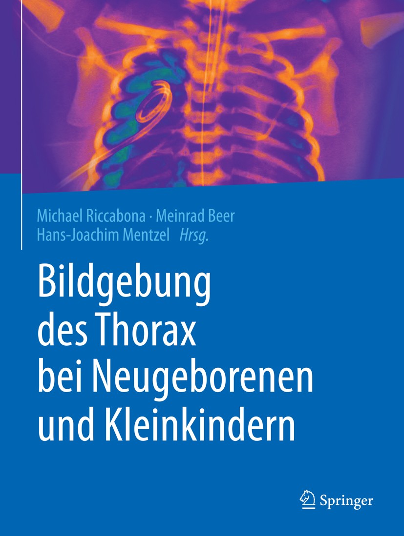 Titlebook: Bildgebung des Thorax bei Neugeborenen und Kleinkindern; Michael Riccabona,Meinrad Beer,Hans-Joachim Mentze Book 2019 Springer-Verlag GmbH Titlebook: Bildgebung des Thorax bei Neugeborenen und Kleinkindern; Michael Riccabona,Meinrad Beer,Hans-Joachim Mentze Book 2019 Springer-Verlag GmbH