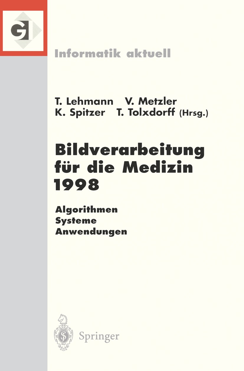 Titlebook: Bildverarbeitung für die Medizin 1998; Algorithmen — System Thomas Lehmann,Volker Metzler,Thomas Tolxdorff Conference proceedings 1998 Spri Titlebook: Bildverarbeitung für die Medizin 1998; Algorithmen — System Thomas Lehmann,Volker Metzler,Thomas Tolxdorff Conference proceedings 1998 Spri