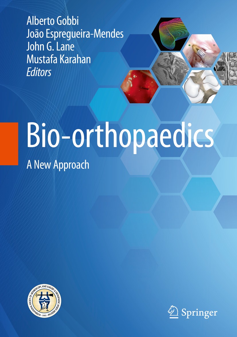 Titlebook: Bio-orthopaedics; A New Approach Alberto Gobbi,João Espregueira-Mendes,Mustafa Kara Book 2017 Springer-Verlag GmbH Germany, part of Springe Titlebook: Bio-orthopaedics; A New Approach Alberto Gobbi,João Espregueira-Mendes,Mustafa Kara Book 2017 Springer-Verlag GmbH Germany, part of Springe