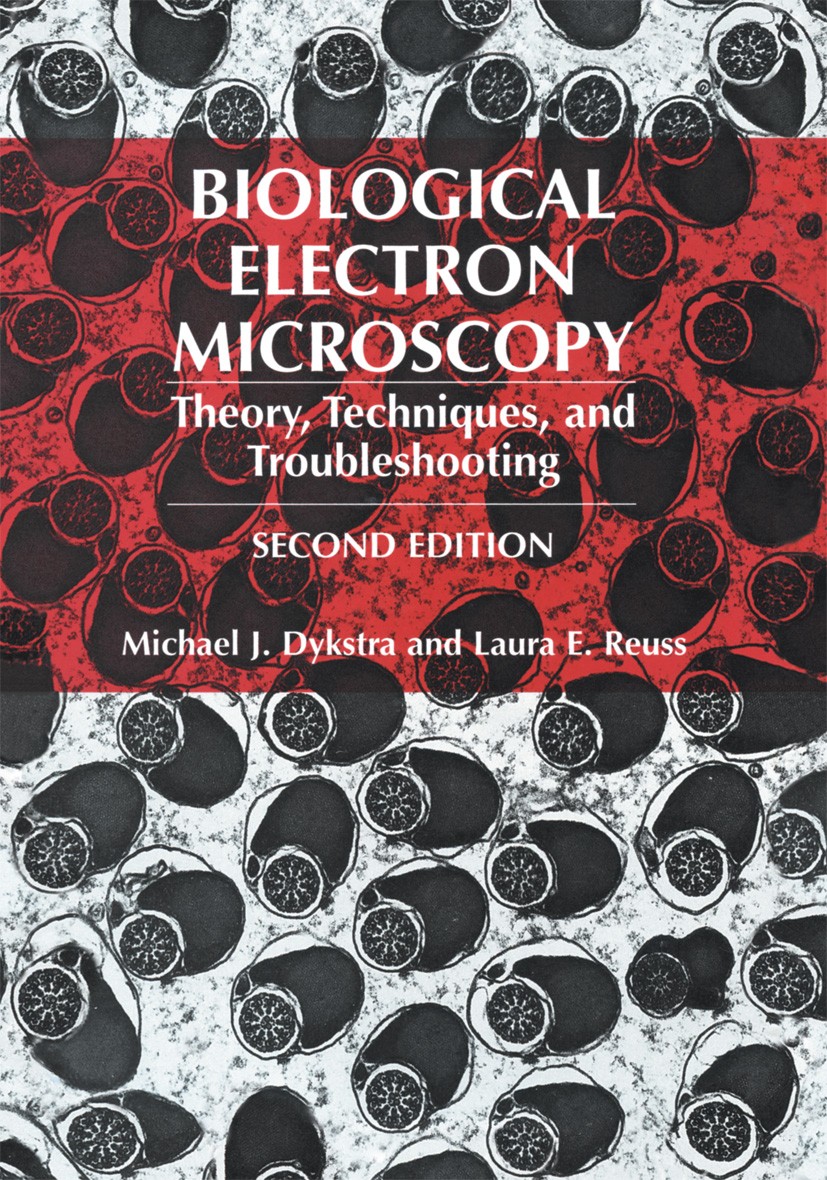 Titlebook: Biological Electron Microscopy; Theory, Techniques, Michael J. Dykstra,Laura E. Reuss Textbook 2003Latest edition Michael J. Dykstra 2003 Titlebook: Biological Electron Microscopy; Theory, Techniques, Michael J. Dykstra,Laura E. Reuss Textbook 2003Latest edition Michael J. Dykstra 2003