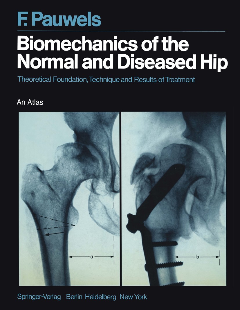 Titlebook: Biomechanics of the Normal and Diseased Hip; Theoretical Foundati Friedrich Pauwels Book 1976 Springer-Verlag Berlin Heidelberg 1976 Biomec Titlebook: Biomechanics of the Normal and Diseased Hip; Theoretical Foundati Friedrich Pauwels Book 1976 Springer-Verlag Berlin Heidelberg 1976 Biomec