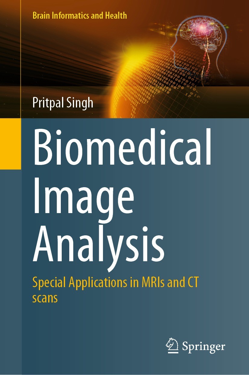 Titlebook: Biomedical Image Analysis; Special Applications Pritpal Singh Book 2024 The Editor(s) (if applicable) and The Author(s), under exclusive li Titlebook: Biomedical Image Analysis; Special Applications Pritpal Singh Book 2024 The Editor(s) (if applicable) and The Author(s), under exclusive li