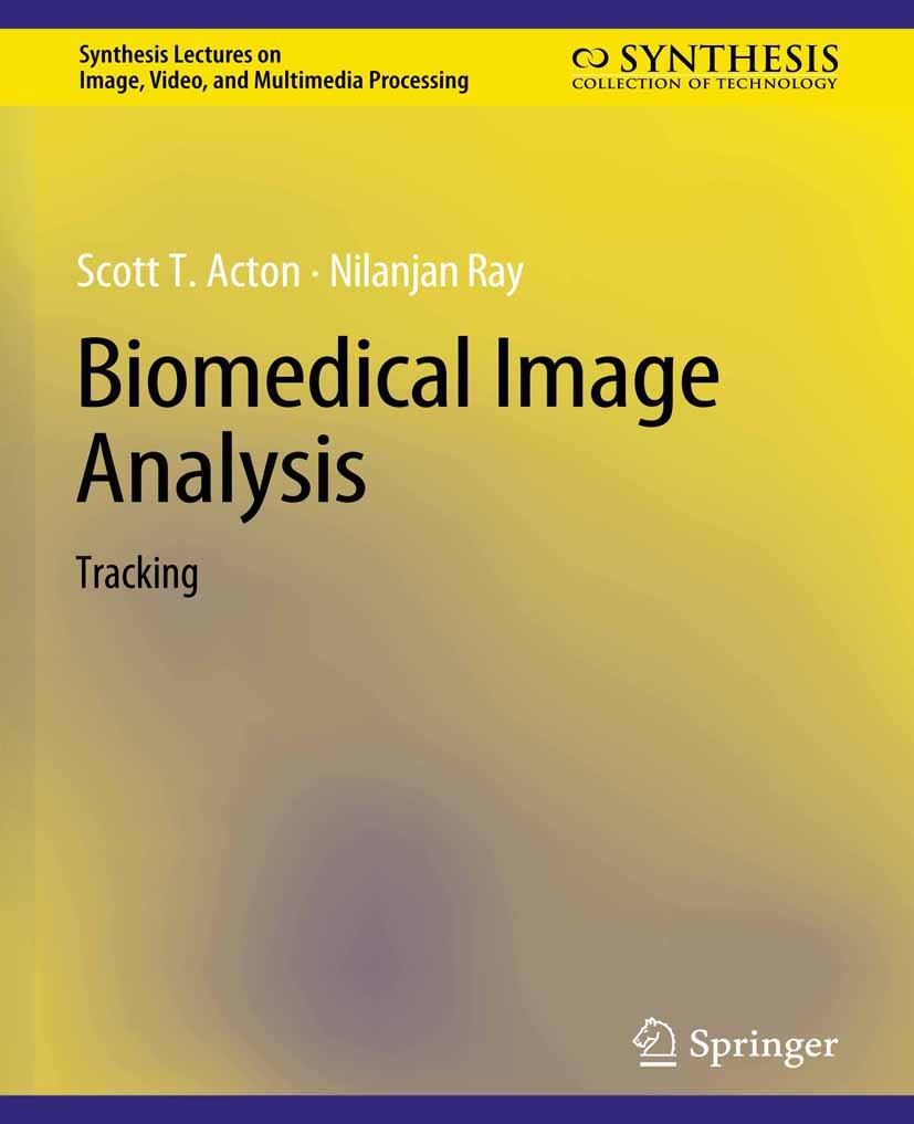 Titlebook: Biomedical Image Analysis; Tracking Scott T. Acton,Nilanjan Ray Book 2006 Springer Nature Switzerland AG 2006 Titlebook: Biomedical Image Analysis; Tracking Scott T. Acton,Nilanjan Ray Book 2006 Springer Nature Switzerland AG 2006