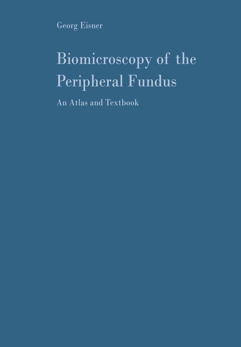 Titlebook: Biomicroscopy of the Peripheral Fundus; An Atlas and Textboo Georg Eisner Textbook 1973 Springer-Verlag Berlin Heidelberg 1973 Amotio retin Titlebook: Biomicroscopy of the Peripheral Fundus; An Atlas and Textboo Georg Eisner Textbook 1973 Springer-Verlag Berlin Heidelberg 1973 Amotio retin