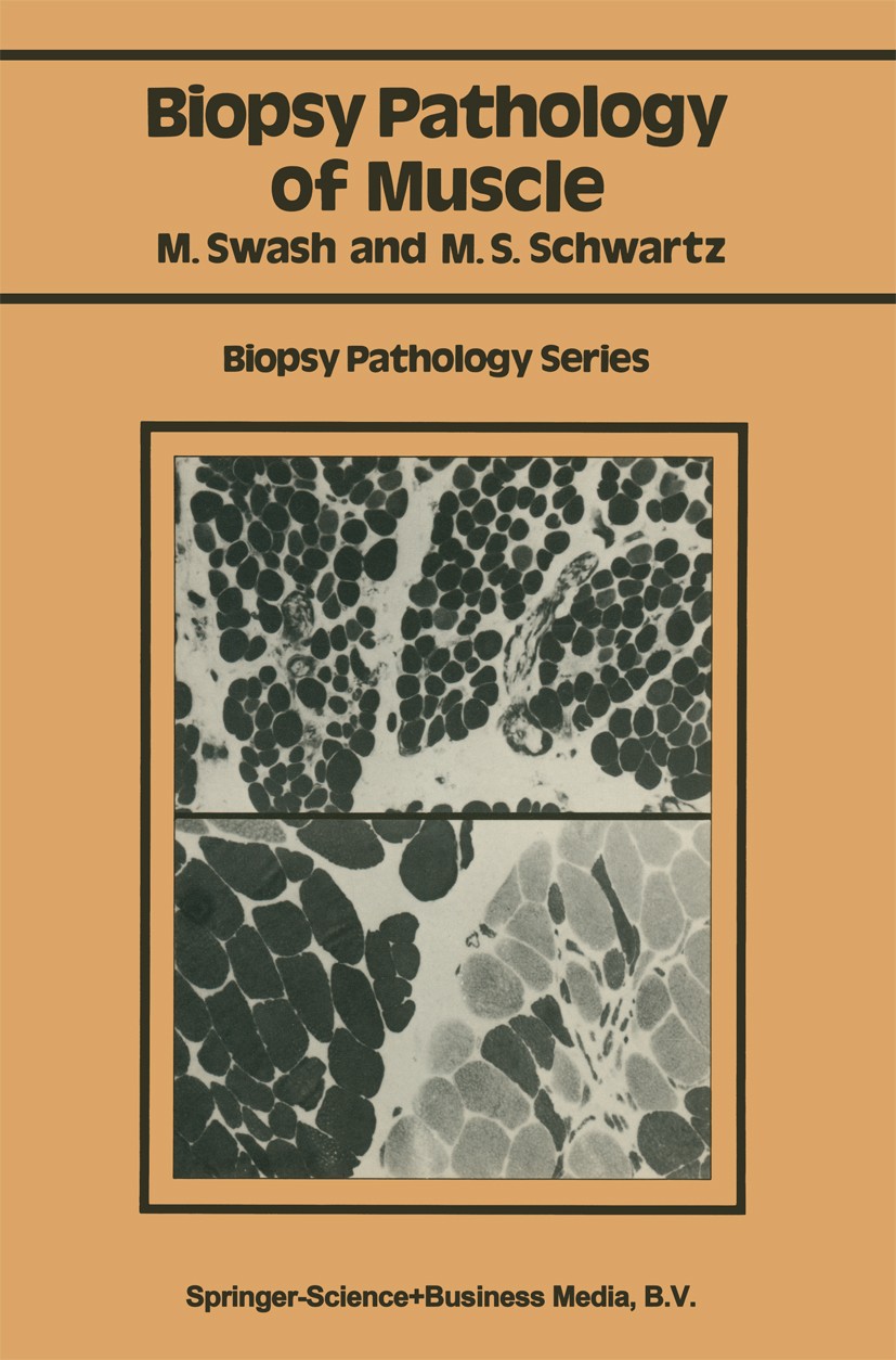 Titlebook: Biopsy pathology of muscle; Michael Swash,Martin S. Schwartz Book 1984 Springer Science+Business Media New York 1984 biopsy.electron micro Titlebook: Biopsy pathology of muscle; Michael Swash,Martin S. Schwartz Book 1984 Springer Science+Business Media New York 1984 biopsy.electron micro