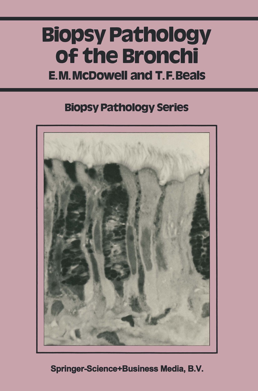 Titlebook: Biopsy Pathology of the Bronchi; Elizabeth M. McDowell,Theodore F. Beals Book 1986 E.M. McDowell and T.F. Beals 1986 biopsy.cell.cytology. Titlebook: Biopsy Pathology of the Bronchi; Elizabeth M. McDowell,Theodore F. Beals Book 1986 E.M. McDowell and T.F. Beals 1986 biopsy.cell.cytology.