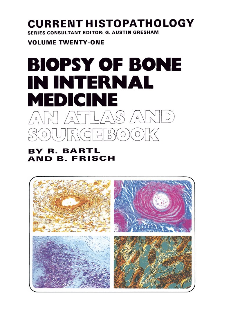 Titlebook: Biopsy of Bone in Internal Medicine: An Atlas and Sourcebook; R. Bartl,B. Frisch Book 1993 R. Bartl and B. Frisch 1993 Internal medicine.b Titlebook: Biopsy of Bone in Internal Medicine: An Atlas and Sourcebook; R. Bartl,B. Frisch Book 1993 R. Bartl and B. Frisch 1993 Internal medicine.b