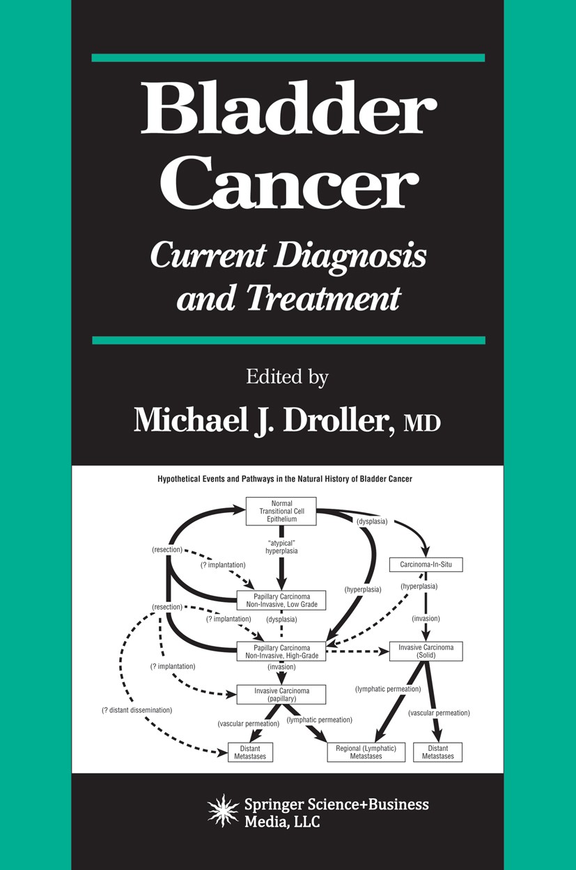 Titlebook: Bladder Cancer; Current Diagnosis an Michael J. Droller Book 2001 Springer Science+Business Media New York 2001 Staging.cancer.carcinogenes Titlebook: Bladder Cancer; Current Diagnosis an Michael J. Droller Book 2001 Springer Science+Business Media New York 2001 Staging.cancer.carcinogenes