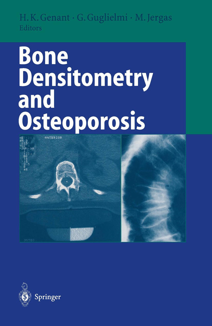 Titlebook: Bone Densitometry and Osteoporosis; Harry K. Genant (Chief,Musculoskeletal Radiology, Book 1998 Springer-Verlag Berlin Heidelberg 1998 X- Titlebook: Bone Densitometry and Osteoporosis; Harry K. Genant (Chief,Musculoskeletal Radiology, Book 1998 Springer-Verlag Berlin Heidelberg 1998 X-