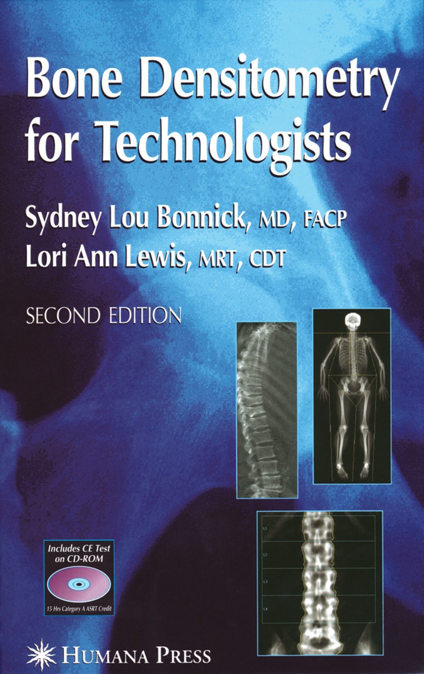 Titlebook: Bone Densitometry for Technologists; Sydney Lou Bonnick,Lori Ann Lewis Book 2006Latest edition Humana Press 2006 Monitor.bone.computed tom Titlebook: Bone Densitometry for Technologists; Sydney Lou Bonnick,Lori Ann Lewis Book 2006Latest edition Humana Press 2006 Monitor.bone.computed tom