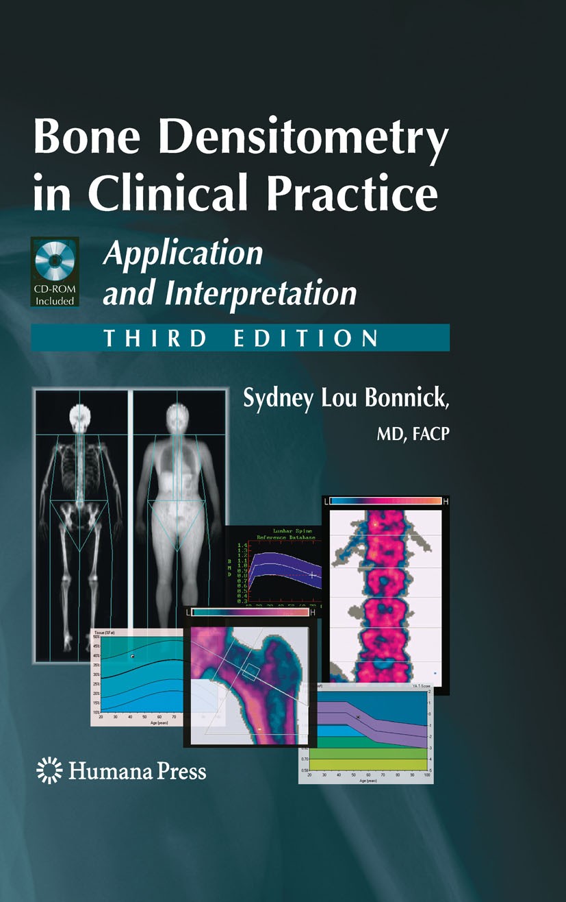 Titlebook: Bone Densitometry in Clinical Practice; Application and Inte Sydney Lou Bonnick Book 2010Latest edition Humana Press 2010 Bisphosphonates.B Titlebook: Bone Densitometry in Clinical Practice; Application and Inte Sydney Lou Bonnick Book 2010Latest edition Humana Press 2010 Bisphosphonates.B