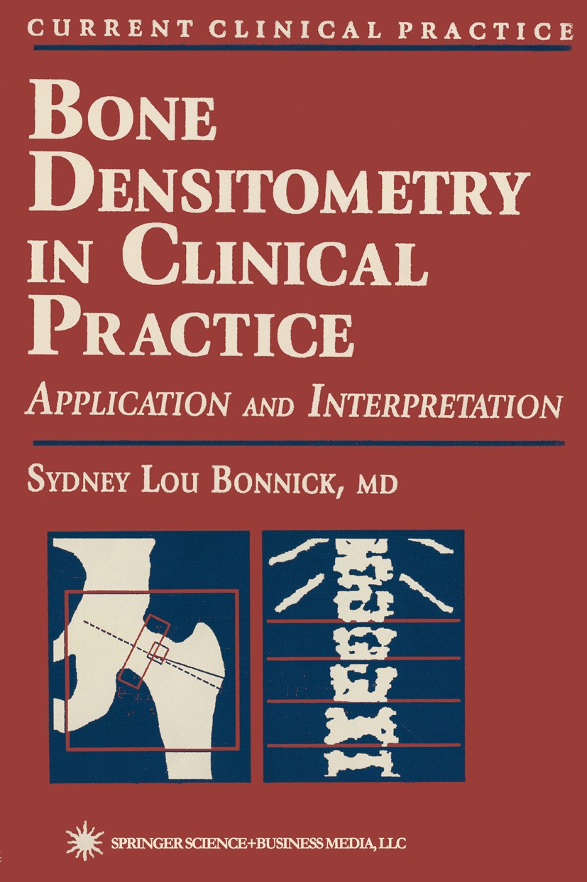 Titlebook: Bone Densitometry in Clinical Practice; Sydney Lou Bonnick Book 19981st edition Humana Press 1998 care.children.clinical application.compu Titlebook: Bone Densitometry in Clinical Practice; Sydney Lou Bonnick Book 19981st edition Humana Press 1998 care.children.clinical application.compu