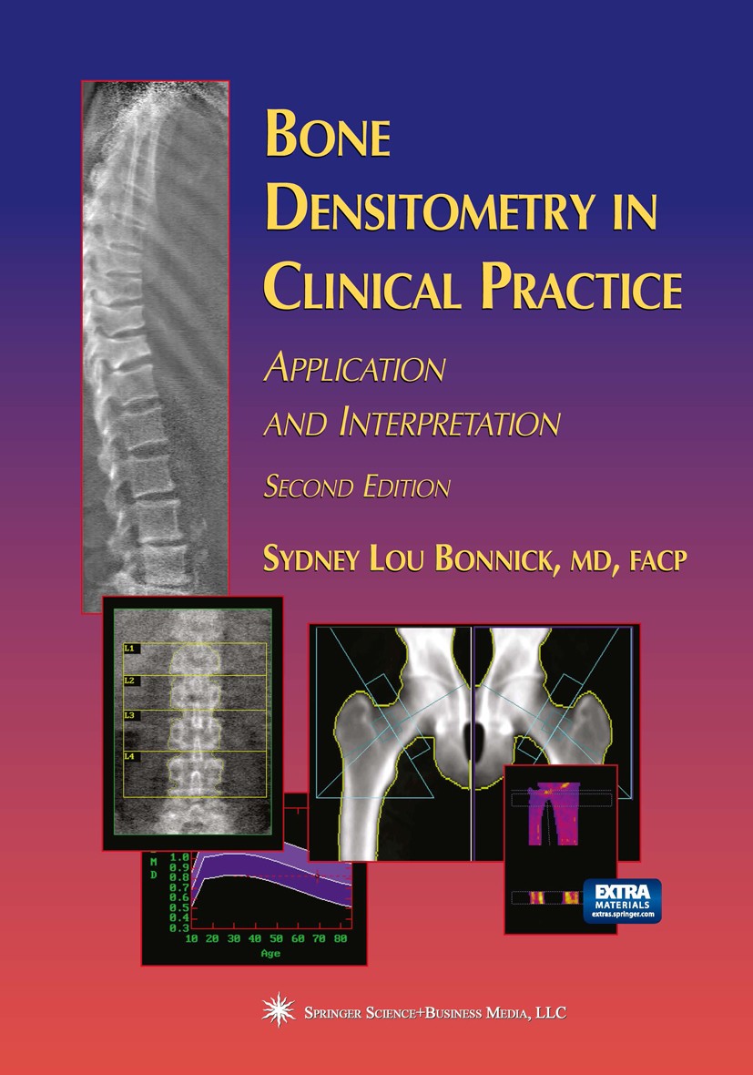 Titlebook: Bone Densitometry in Clinical Practice; Application and Inte Sydney Lou Bonnick Book 20042nd edition Springer Science+Business Media New Yo Titlebook: Bone Densitometry in Clinical Practice; Application and Inte Sydney Lou Bonnick Book 20042nd edition Springer Science+Business Media New Yo