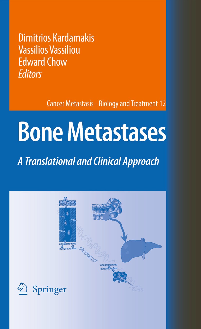 Titlebook: Bone Metastases; A translational and Dimitrios Kardamakis,Vassilios Vassiliou,Edward Ch Book 20091st edition Springer Science+Business Med Titlebook: Bone Metastases; A translational and Dimitrios Kardamakis,Vassilios Vassiliou,Edward Ch Book 20091st edition Springer Science+Business Med