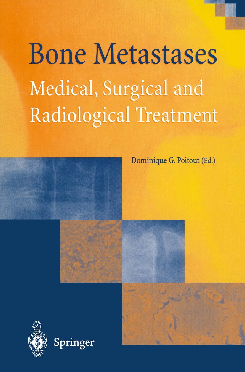Titlebook: Bone Metastases; Medical, Surgical an Dominique G. Poitout (Prof. Chief of Dept.) Book 2002 Springer-Verlag London 2002 bone metastases.bon Titlebook: Bone Metastases; Medical, Surgical an Dominique G. Poitout (Prof. Chief of Dept.) Book 2002 Springer-Verlag London 2002 bone metastases.bon