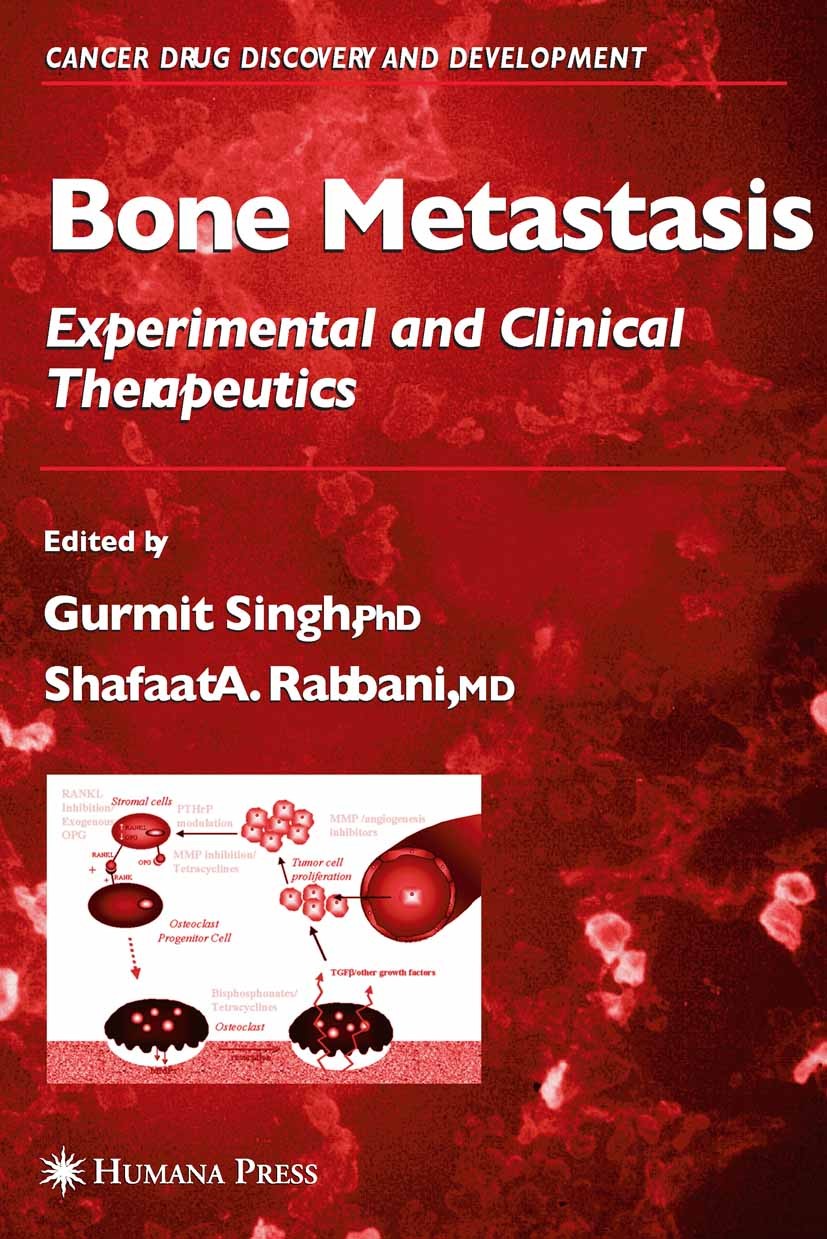 Titlebook: Bone Metastasis; Gurmit Singh,Shafaat A. Rabbani Book 2005 Humana Press 2005 angiogenesis.bisphosphonates.cancer.cell.hormones.metastasis. Titlebook: Bone Metastasis; Gurmit Singh,Shafaat A. Rabbani Book 2005 Humana Press 2005 angiogenesis.bisphosphonates.cancer.cell.hormones.metastasis.
