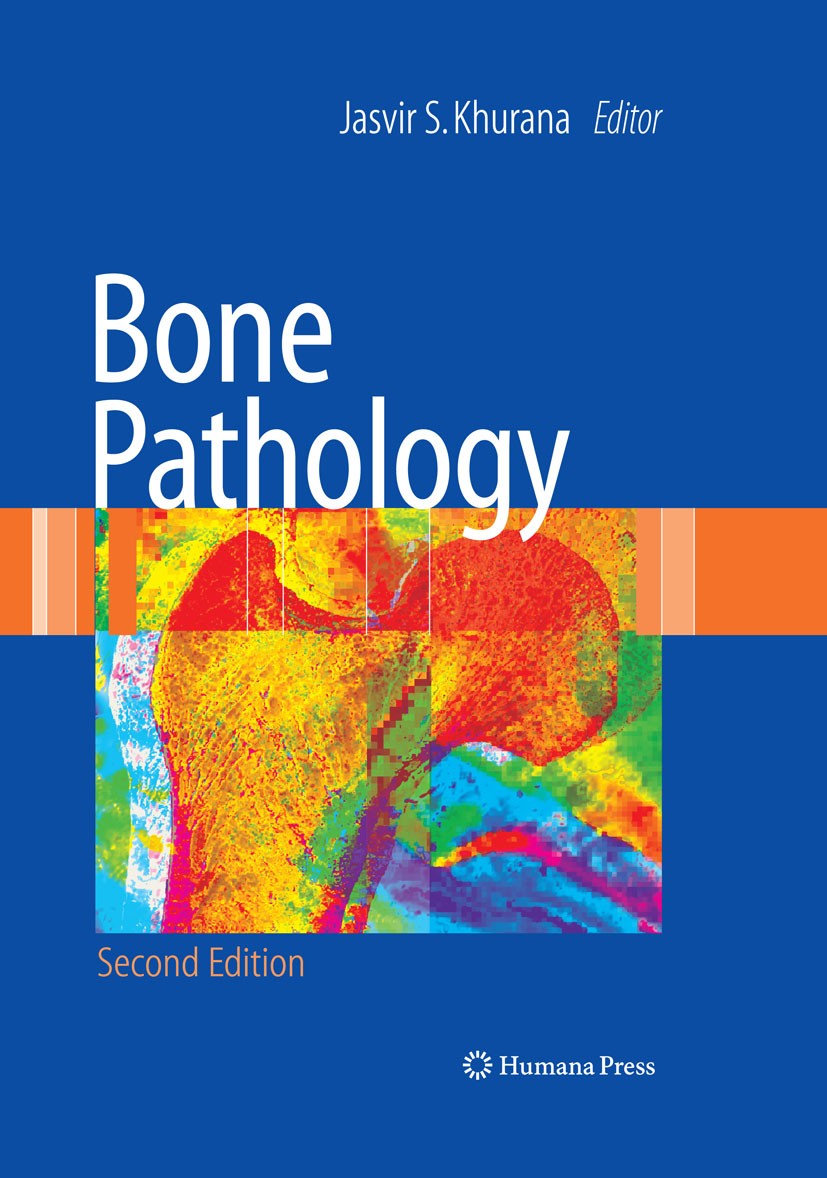 Titlebook: Bone Pathology; Jasvir S. Khurana Book 2009Latest edition Humana Press 2009 Arthropathie.Arthropathies.Biomechanics.Bone histomorphometry. Titlebook: Bone Pathology; Jasvir S. Khurana Book 2009Latest edition Humana Press 2009 Arthropathie.Arthropathies.Biomechanics.Bone histomorphometry.