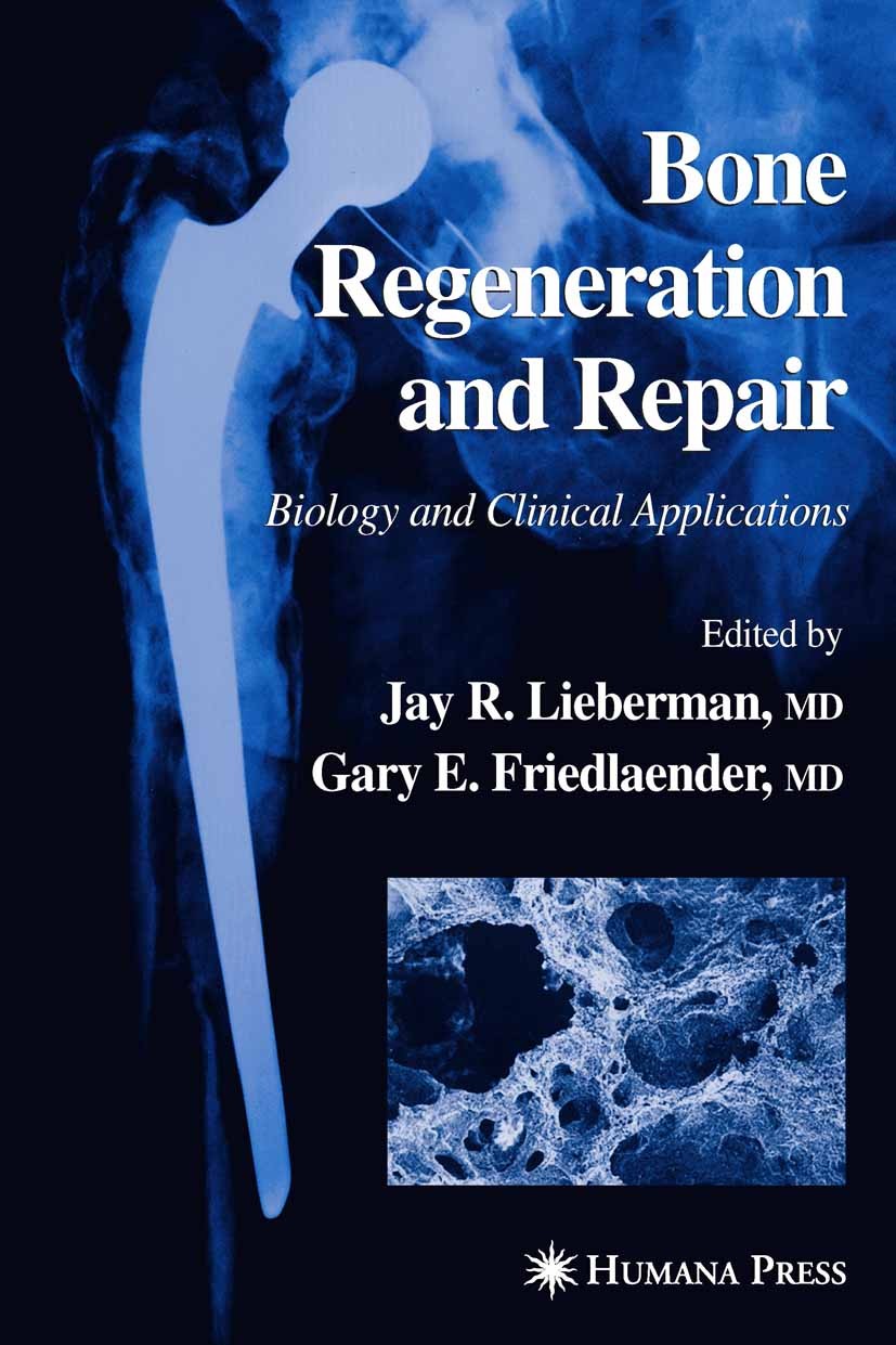Titlebook: Bone Regeneration and Repair; Biology and Clinical Jay R. Lieberman,Gary E. Friedlaender Book 2005 Humana Press 2005 arthroplasty.bone.clin Titlebook: Bone Regeneration and Repair; Biology and Clinical Jay R. Lieberman,Gary E. Friedlaender Book 2005 Humana Press 2005 arthroplasty.bone.clin