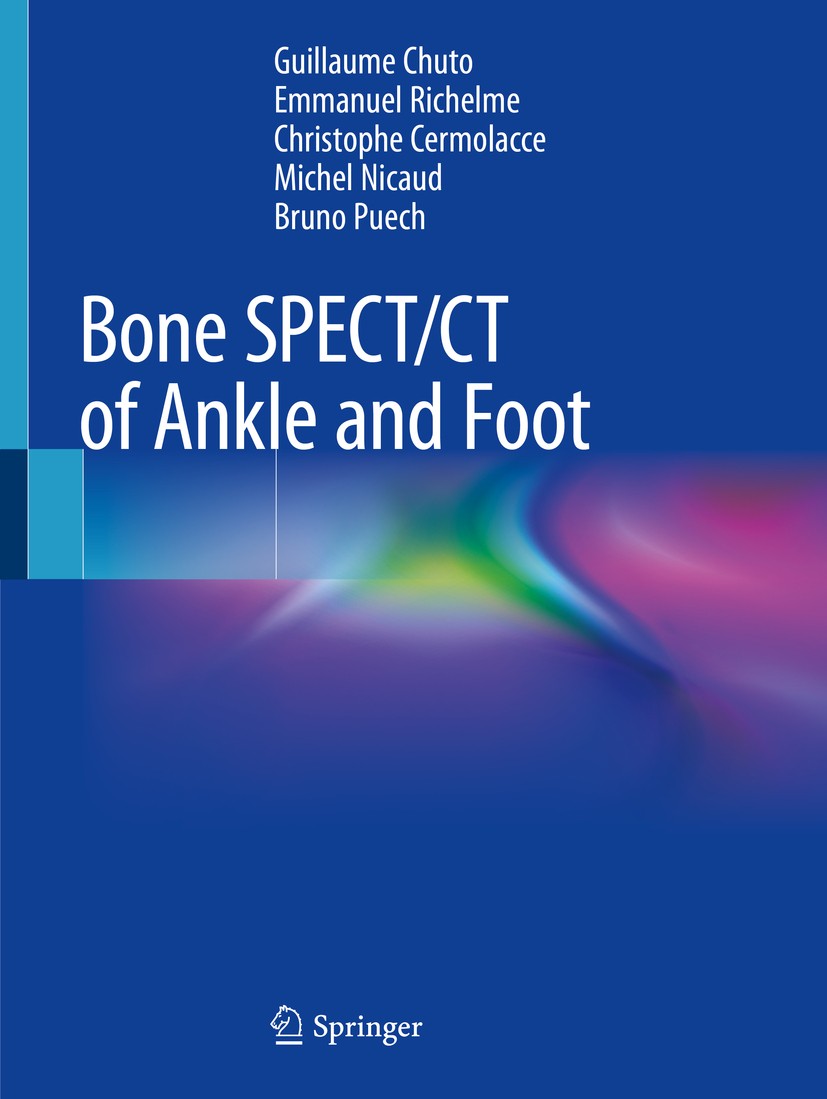 Titlebook: Bone SPECT/CT of Ankle and Foot; Guillaume Chuto,Emmanuel Richelme,Bruno Puech Book 2018 Springer International Publishing AG, part of Spr Titlebook: Bone SPECT/CT of Ankle and Foot; Guillaume Chuto,Emmanuel Richelme,Bruno Puech Book 2018 Springer International Publishing AG, part of Spr