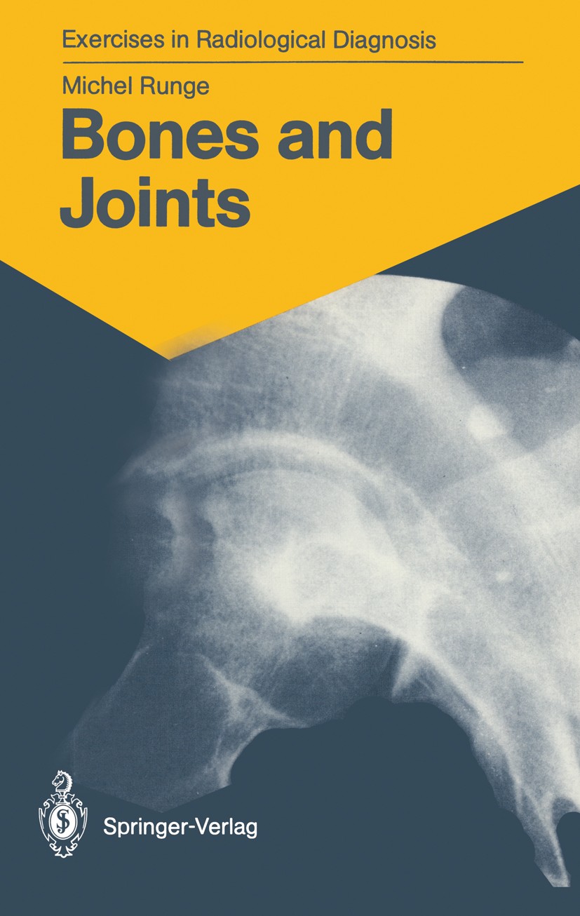 Titlebook: Bones and Joints; 170 Radiological Exe Michel Runge Textbook 1987 Springer-Verlag Berlin Heidelberg 1987 computed tomography.computed tomog Titlebook: Bones and Joints; 170 Radiological Exe Michel Runge Textbook 1987 Springer-Verlag Berlin Heidelberg 1987 computed tomography.computed tomog
