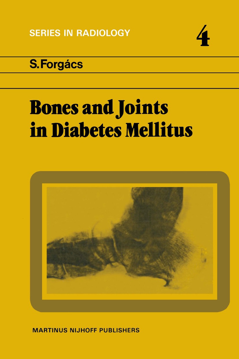 Titlebook: Bones and Joints in Diabetes Mellitus; S. Forgács Book 1982 Akadémiai Kiadó, Budapest 1982 Diabetes.Diabetes mellitus.bone.diagnosis.metab Titlebook: Bones and Joints in Diabetes Mellitus; S. Forgács Book 1982 Akadémiai Kiadó, Budapest 1982 Diabetes.Diabetes mellitus.bone.diagnosis.metab