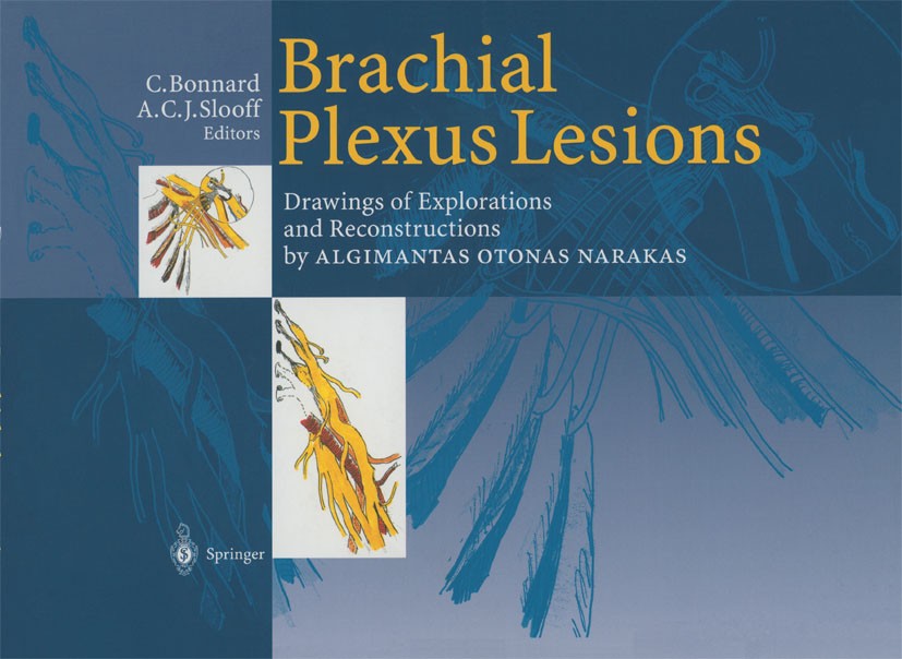 Titlebook: Brachial Plexus Lesions; Drawings of Explorat Chantal Bonnard,Bart Slooff (Neurosurgeon (emeritu Book 1999Latest edition Springer-Verlag Be Titlebook: Brachial Plexus Lesions; Drawings of Explorat Chantal Bonnard,Bart Slooff (Neurosurgeon (emeritu Book 1999Latest edition Springer-Verlag Be