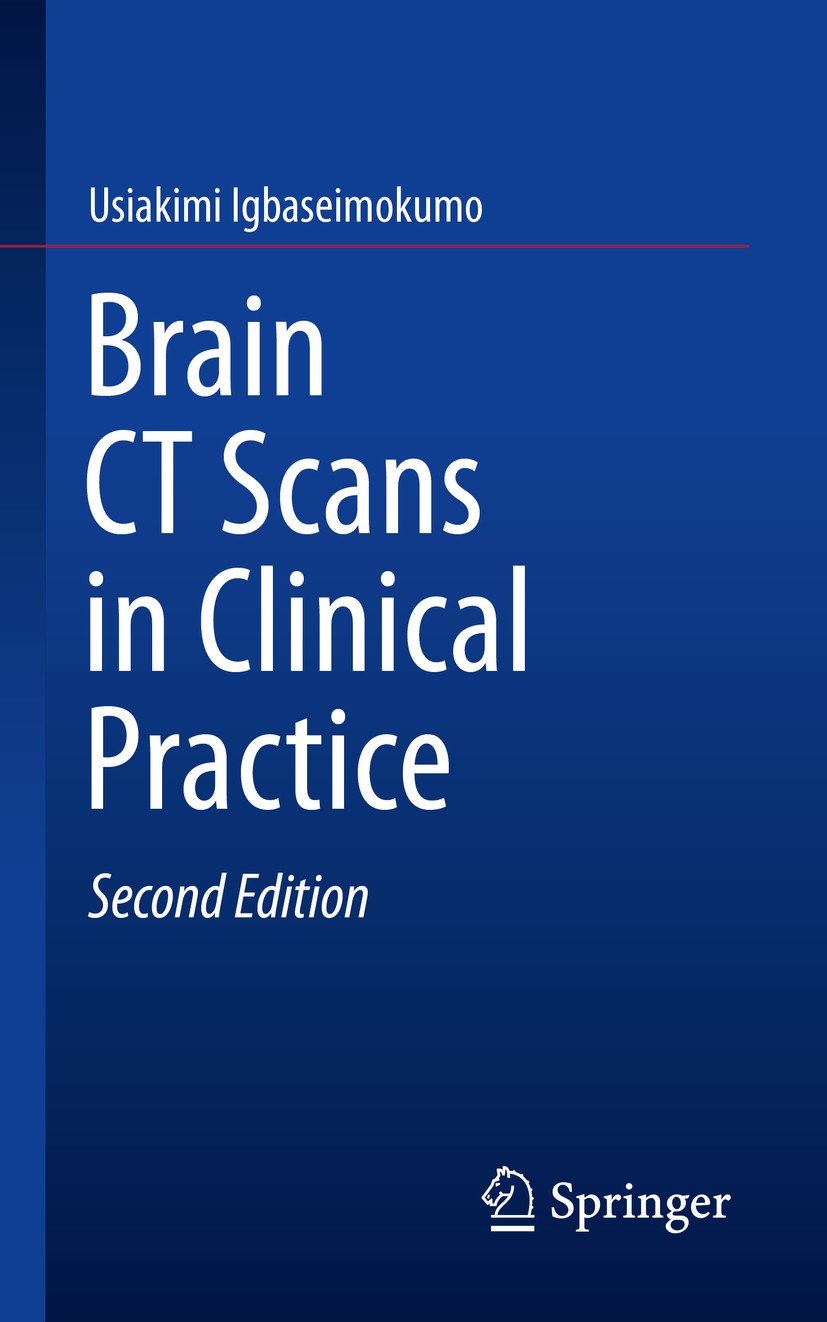 Titlebook: Brain CT Scans in Clinical Practice; Usiakimi Igbaseimokumo Book 2019Latest edition Springer Nature Switzerland AG 2019 Hydrocephalus.brai Titlebook: Brain CT Scans in Clinical Practice; Usiakimi Igbaseimokumo Book 2019Latest edition Springer Nature Switzerland AG 2019 Hydrocephalus.brai