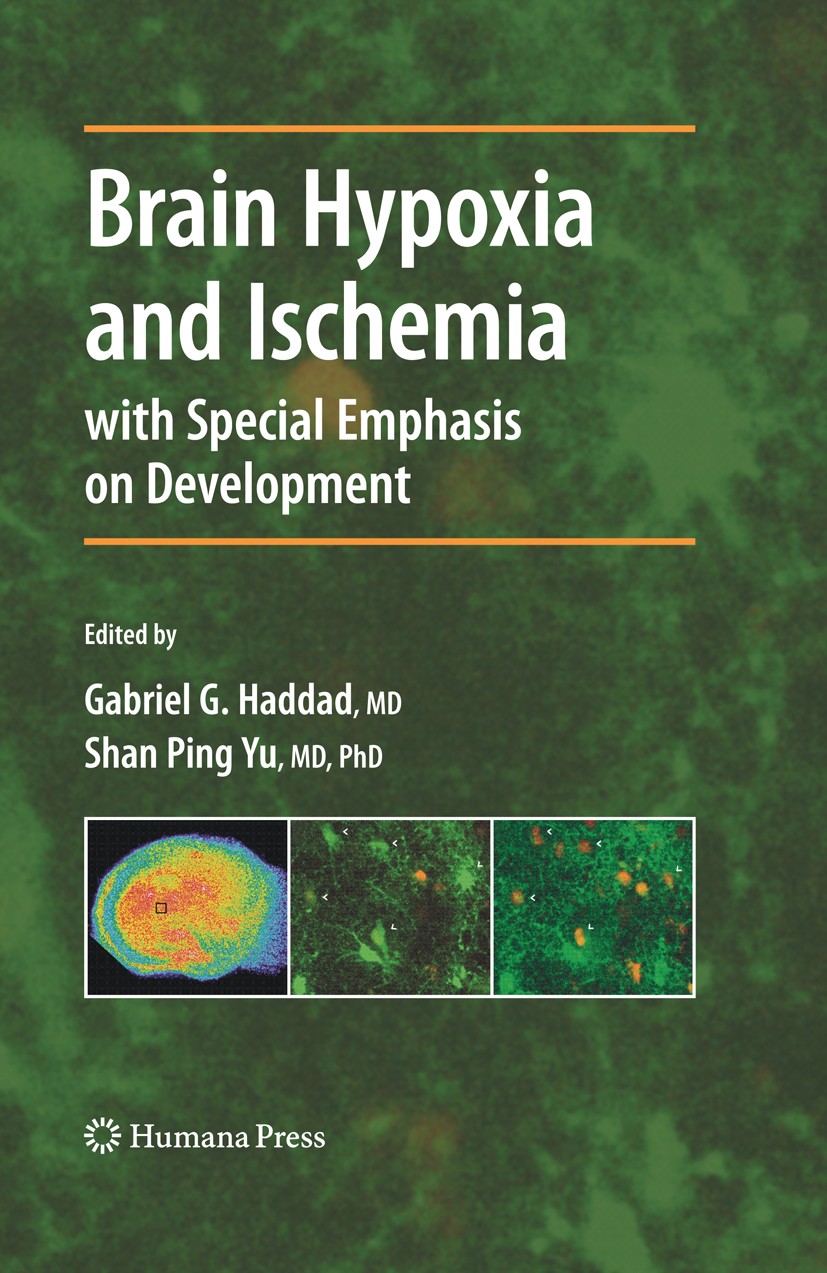 Titlebook: Brain Hypoxia and Ischemia; Gabriel G. Haddad,Shan Ping Yu Book 2009 Humana Press 2009 Brain.Clinical.Contemporary.Deprivation.Haddad.Hypo Titlebook: Brain Hypoxia and Ischemia; Gabriel G. Haddad,Shan Ping Yu Book 2009 Humana Press 2009 Brain.Clinical.Contemporary.Deprivation.Haddad.Hypo