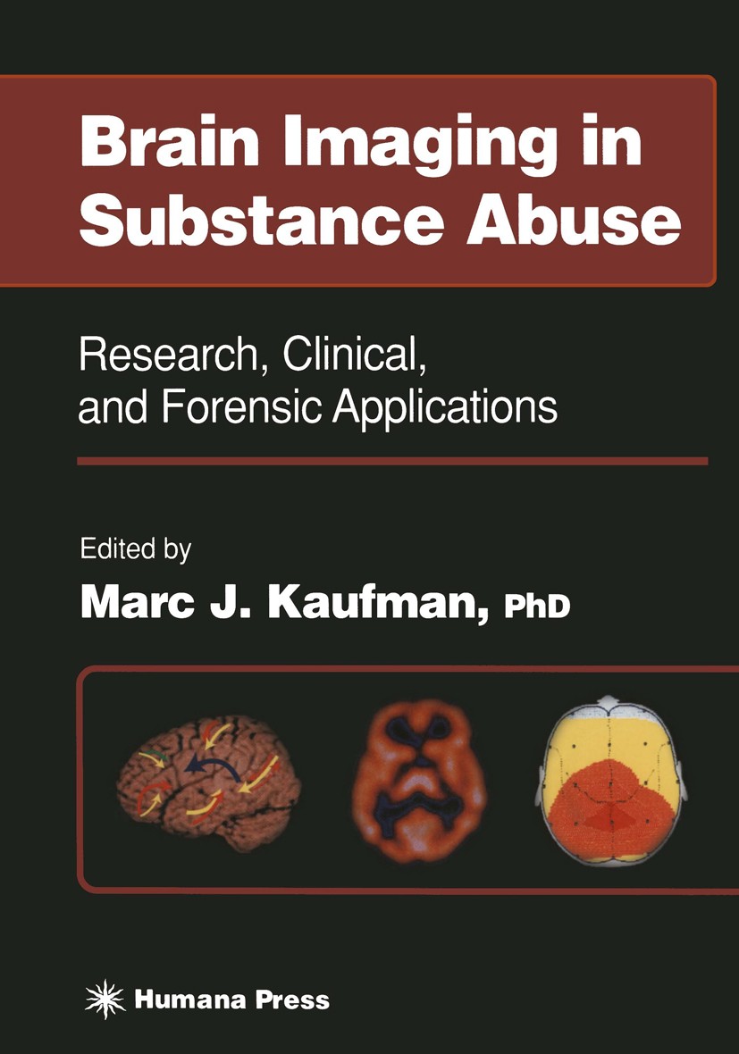 Titlebook: Brain Imaging in Substance Abuse; Research, Clinical, Marc J. Kaufman (Assistant Professor of Psychiatry Book 2001 Springer Science+Busine Titlebook: Brain Imaging in Substance Abuse; Research, Clinical, Marc J. Kaufman (Assistant Professor of Psychiatry Book 2001 Springer Science+Busine