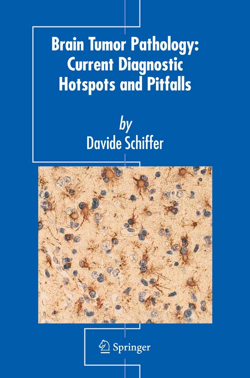 Titlebook: Brain Tumor Pathology: Current Diagnostic Hotspots and Pitfalls; Davide Schiffer Book 2006 Springer Science+Business Media B.V. 2006 angio Titlebook: Brain Tumor Pathology: Current Diagnostic Hotspots and Pitfalls; Davide Schiffer Book 2006 Springer Science+Business Media B.V. 2006 angio
