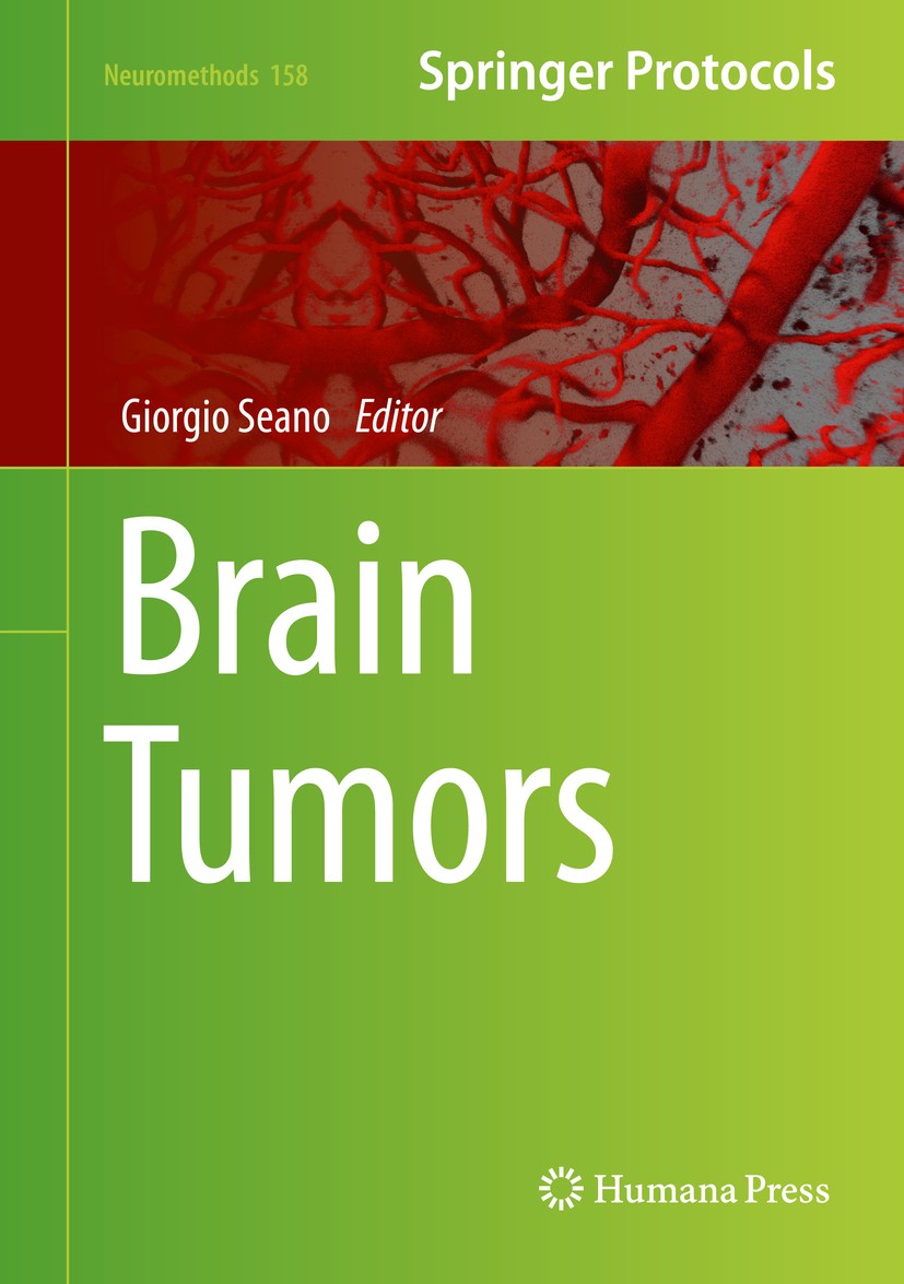 Titlebook: Brain Tumors; Giorgio Seano Book 2021 Springer Science+Business Media, LLC, part of Springer Nature 2021 brain metastases.microscopy.cereb Titlebook: Brain Tumors; Giorgio Seano Book 2021 Springer Science+Business Media, LLC, part of Springer Nature 2021 brain metastases.microscopy.cereb