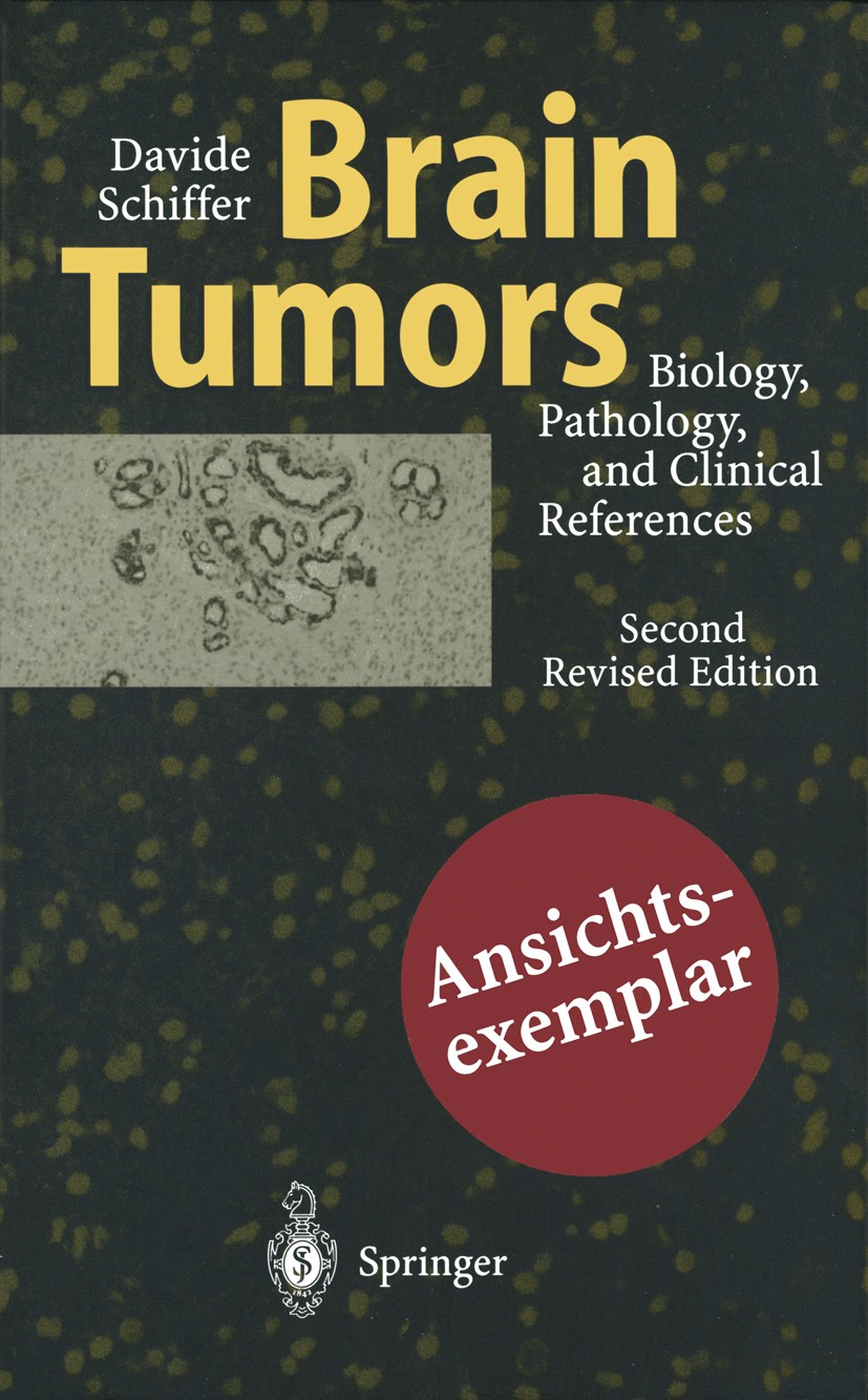 Titlebook: Brain Tumors; Biology, Pathology a Davide Schiffer,Maria Teresa Giordana,Riccardo Sof Book 1997Latest edition Springer-Verlag Berlin Heidel Titlebook: Brain Tumors; Biology, Pathology a Davide Schiffer,Maria Teresa Giordana,Riccardo Sof Book 1997Latest edition Springer-Verlag Berlin Heidel