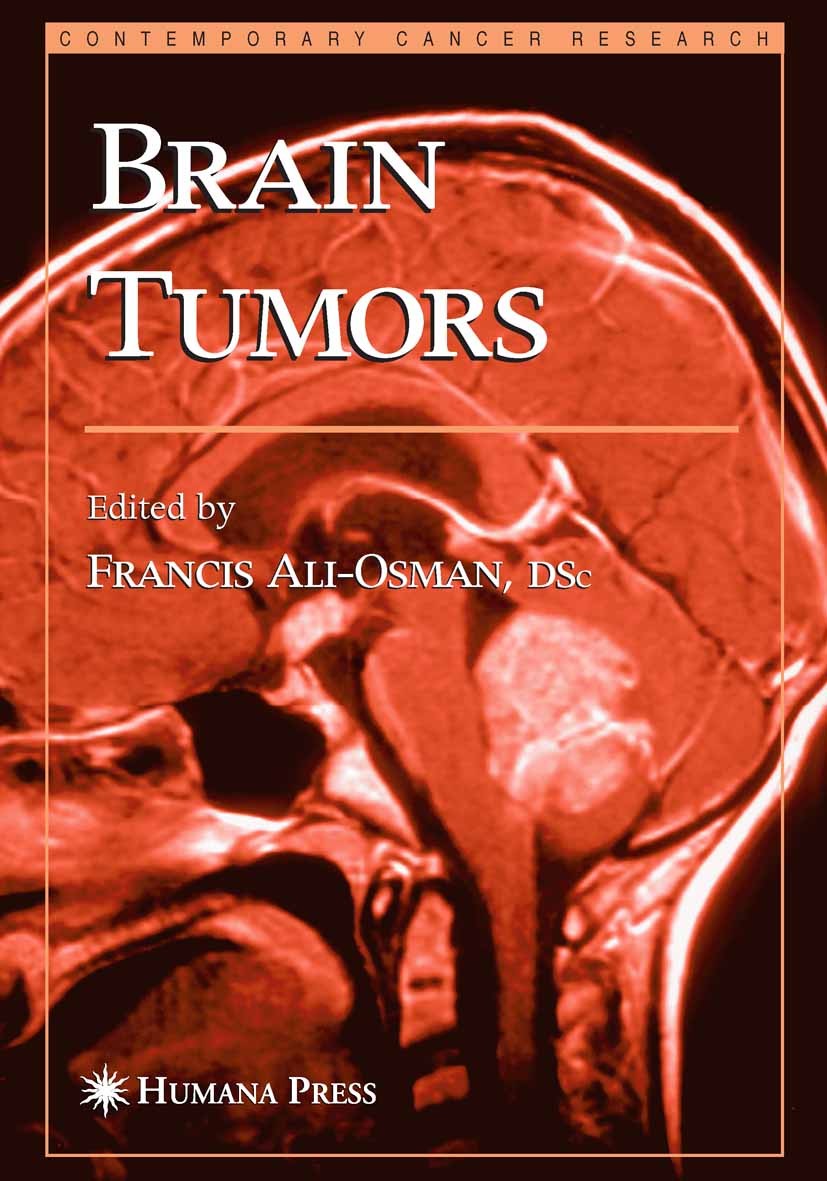 Titlebook: Brain Tumors; Francis Ali-Osman Book 2005 Humana Press 2005 Nervous System.apoptosis.classification.histopathology.imaging Titlebook: Brain Tumors; Francis Ali-Osman Book 2005 Humana Press 2005 Nervous System.apoptosis.classification.histopathology.imaging