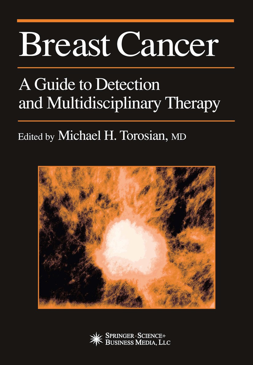 Titlebook: Breast Cancer; A Guide to Detection Michael H. Torosian Book 2002 Springer Science+Business Media New York 2002 biopsy.carcinoma.classifica Titlebook: Breast Cancer; A Guide to Detection Michael H. Torosian Book 2002 Springer Science+Business Media New York 2002 biopsy.carcinoma.classifica