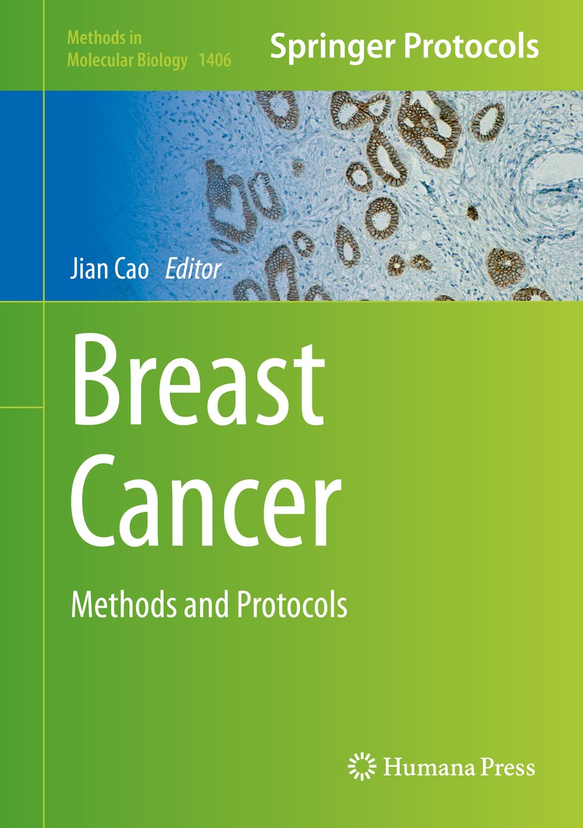 Titlebook: Breast Cancer; Methods and Protocol Jian Cao Book 2016 Springer Science+Business Media New York 2016 diagnosing breast cancer.clinical prac Titlebook: Breast Cancer; Methods and Protocol Jian Cao Book 2016 Springer Science+Business Media New York 2016 diagnosing breast cancer.clinical prac