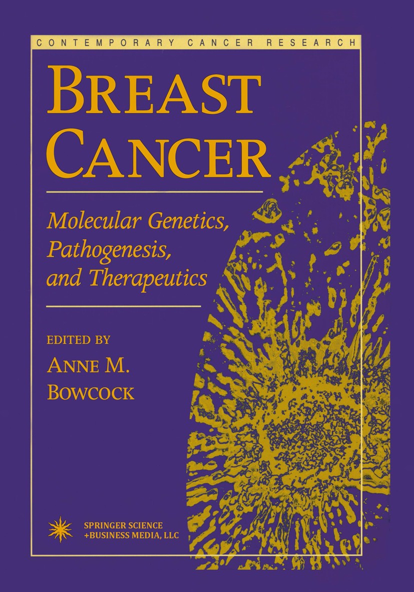 Titlebook: Breast Cancer; Molecular Genetics, Anne M. Bowcock Book 1999 Springer Science+Business Media New York 1999 BRCA.angiogenesis.apoptosis.can Titlebook: Breast Cancer; Molecular Genetics, Anne M. Bowcock Book 1999 Springer Science+Business Media New York 1999 BRCA.angiogenesis.apoptosis.can