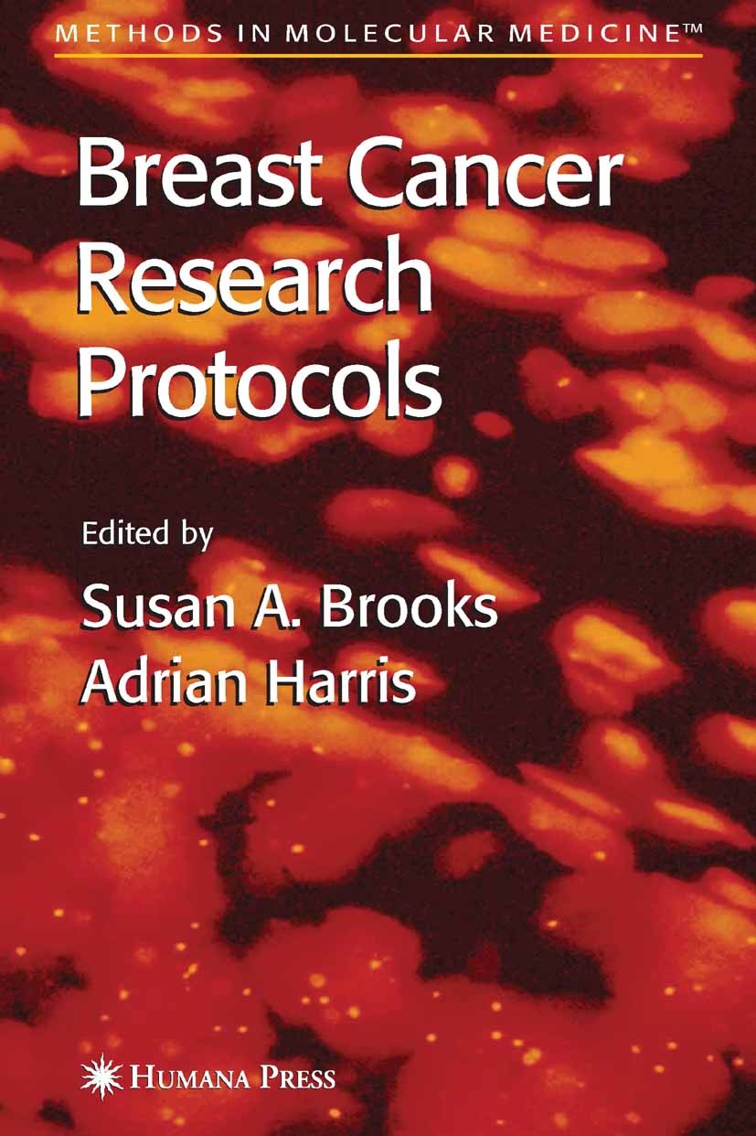 Titlebook: Breast Cancer Research Protocols; Susan A. Brooks,Adrian Harris Book 2006 Humana Press 2006 Biopsie.Endoplasmatisches Reticulum.Migration. Titlebook: Breast Cancer Research Protocols; Susan A. Brooks,Adrian Harris Book 2006 Humana Press 2006 Biopsie.Endoplasmatisches Reticulum.Migration.