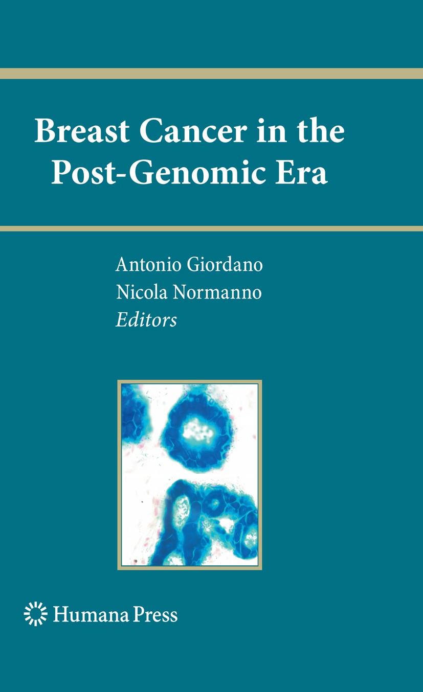 Titlebook: Breast Cancer in the Post-Genomic Era; Antonio Giordano,Nicola Normanno Book 2009 The Editor(s) (if applicable) and The Author(s), under e Titlebook: Breast Cancer in the Post-Genomic Era; Antonio Giordano,Nicola Normanno Book 2009 The Editor(s) (if applicable) and The Author(s), under e