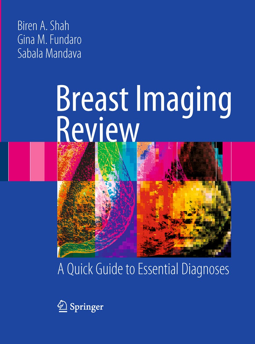 Titlebook: Breast Imaging Review; A Quick Guide to Ess Biren Shah,Gina Fundaro,Sabala Mandava Book 20101st edition Springer-Verlag New York 2010 board Titlebook: Breast Imaging Review; A Quick Guide to Ess Biren Shah,Gina Fundaro,Sabala Mandava Book 20101st edition Springer-Verlag New York 2010 board