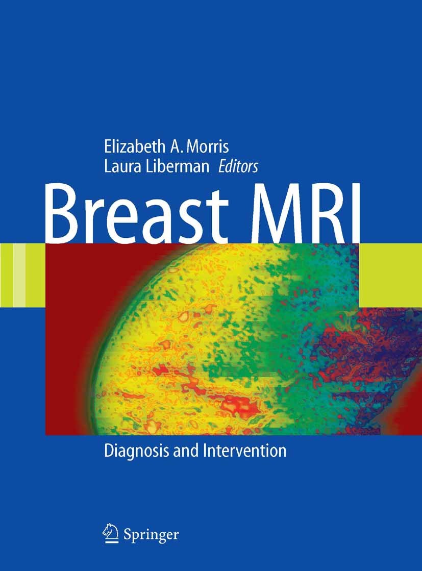 Titlebook: Breast MRI; Diagnosis and Interv Elizabeth A. Morris,Laura Liberman Book 2005 Springer-Verlag New York 2005 Atlas.Staging.Tumor.biopsy.carc Titlebook: Breast MRI; Diagnosis and Interv Elizabeth A. Morris,Laura Liberman Book 2005 Springer-Verlag New York 2005 Atlas.Staging.Tumor.biopsy.carc