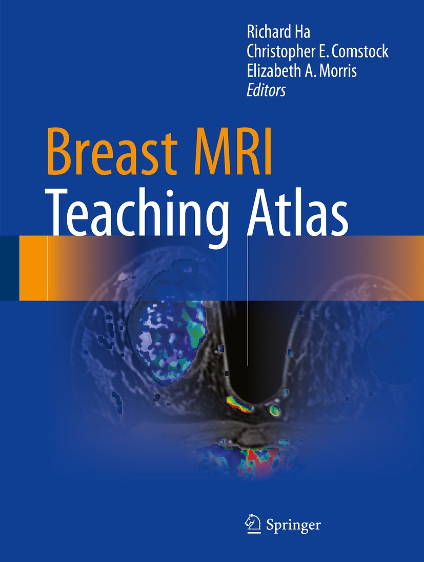 Titlebook: Breast MRI Teaching Atlas; Richard Ha,Christopher E. Comstock,Elizabeth A. Mo Book 2017 Springer New York 2017 Breast MRI.MRI basics.benig Titlebook: Breast MRI Teaching Atlas; Richard Ha,Christopher E. Comstock,Elizabeth A. Mo Book 2017 Springer New York 2017 Breast MRI.MRI basics.benig