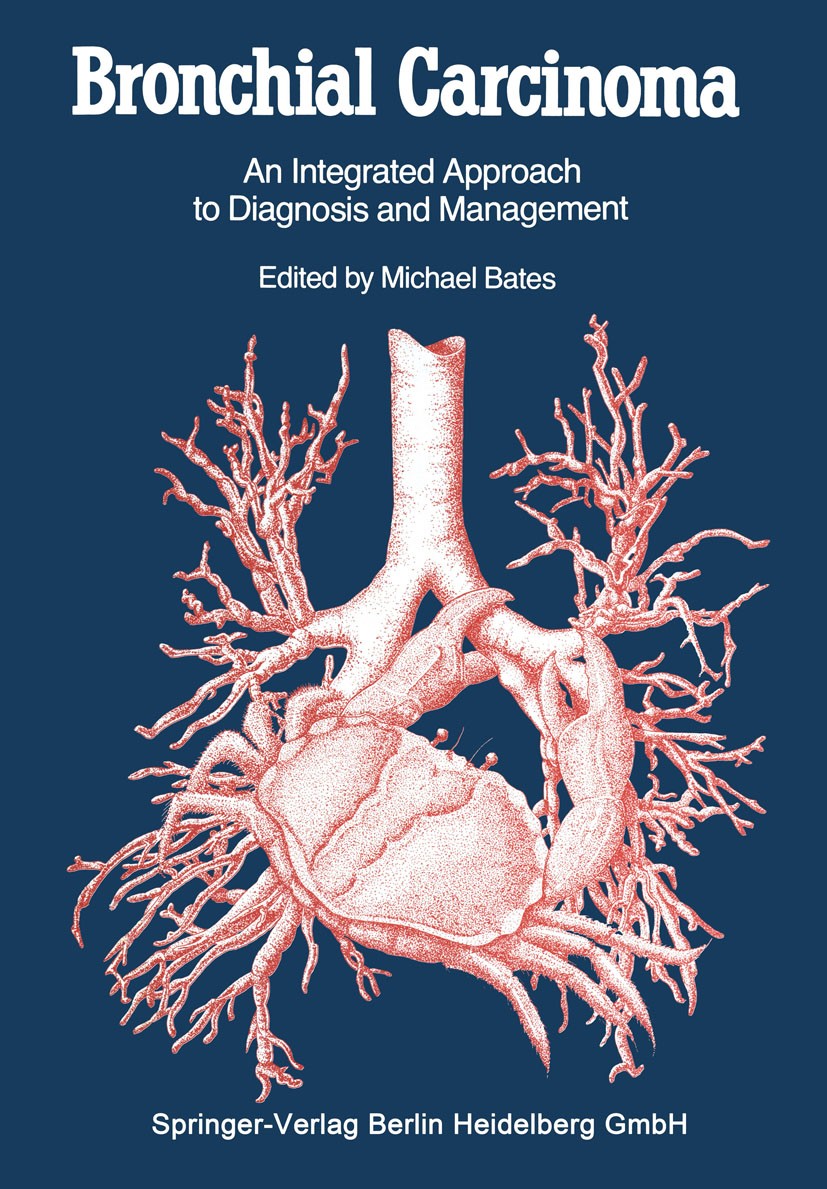 Titlebook: Bronchial Carcinoma; An Integrated Approa Michael Bates Book 1984 Springer-Verlag Berlin Heidelberg 1984 CT.biopsy.cancer.carcinoma.compute Titlebook: Bronchial Carcinoma; An Integrated Approa Michael Bates Book 1984 Springer-Verlag Berlin Heidelberg 1984 CT.biopsy.cancer.carcinoma.compute