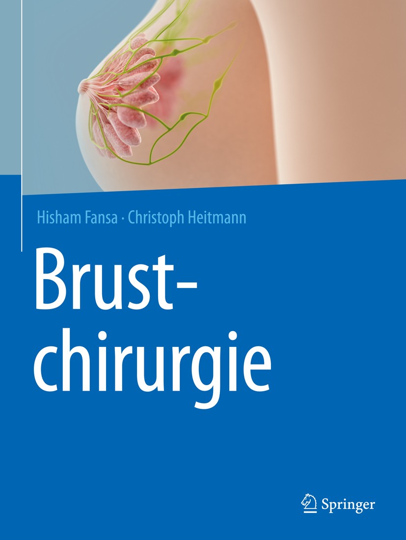 Titlebook: Brustchirurgie; Hisham Fansa,Christoph Heitmann Book 2018 Springer-Verlag GmbH Deutschland, ein Teil von Springer Nature 2018 Augmentation Titlebook: Brustchirurgie; Hisham Fansa,Christoph Heitmann Book 2018 Springer-Verlag GmbH Deutschland, ein Teil von Springer Nature 2018 Augmentation