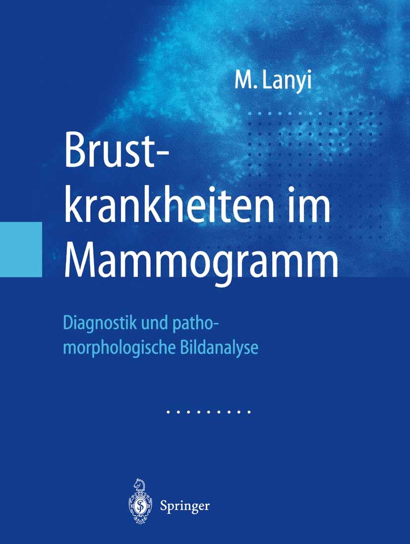 Titlebook: Brustkrankheiten im Mammogramm; Diagnostik und patho Marton Lanyi Book 2003 Springer-Verlag Berlin Heidelberg 2003 Diagnose.Diagnostik.Homo Titlebook: Brustkrankheiten im Mammogramm; Diagnostik und patho Marton Lanyi Book 2003 Springer-Verlag Berlin Heidelberg 2003 Diagnose.Diagnostik.Homo