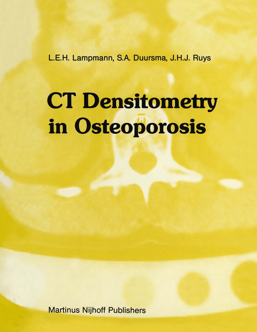 Titlebook: CT Densitometry in Osteoporosis; The impact on manage L. E. H. Lampmann,S. A. Duursma,J. H. J. Ruys Book 1984 Martinus Nijhoff Publishers, Titlebook: CT Densitometry in Osteoporosis; The impact on manage L. E. H. Lampmann,S. A. Duursma,J. H. J. Ruys Book 1984 Martinus Nijhoff Publishers,