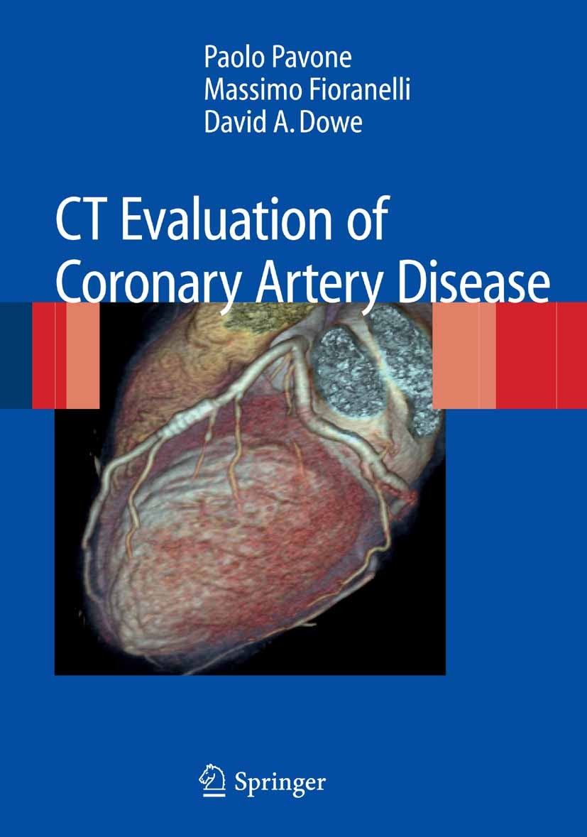 Titlebook: CT Evaluation of Coronary Artery Disease; Paolo Pavone,Massimo Fioranelli,David A. Dowe Book 20091st edition Springer-Verlag Milan 2009 By Titlebook: CT Evaluation of Coronary Artery Disease; Paolo Pavone,Massimo Fioranelli,David A. Dowe Book 20091st edition Springer-Verlag Milan 2009 By