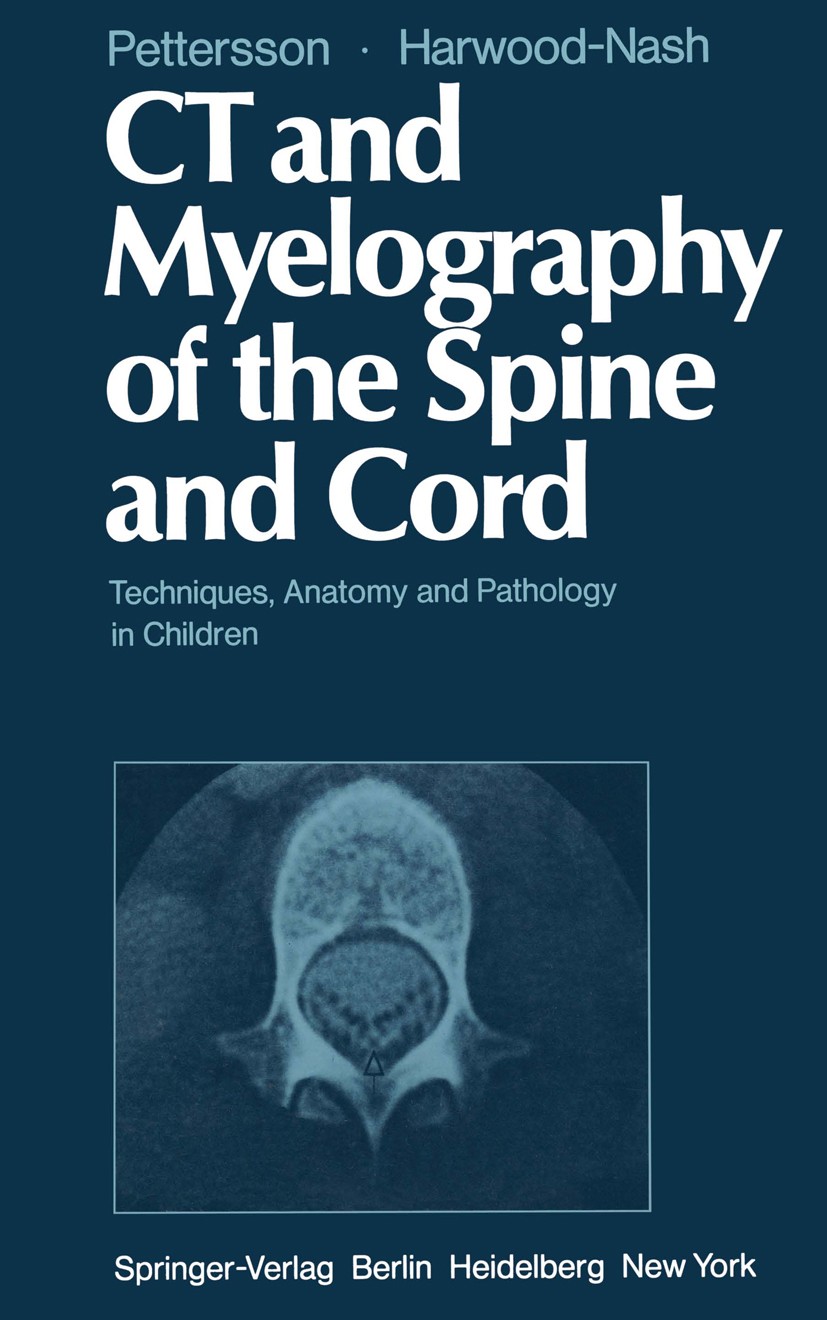 Titlebook: CT and Myelography of the Spine and Cord; Techniques, Anatomy Holger Pettersson,Derek C. F. Harwood-Nash Book 1982 Springer-Verlag Berlin Titlebook: CT and Myelography of the Spine and Cord; Techniques, Anatomy Holger Pettersson,Derek C. F. Harwood-Nash Book 1982 Springer-Verlag Berlin