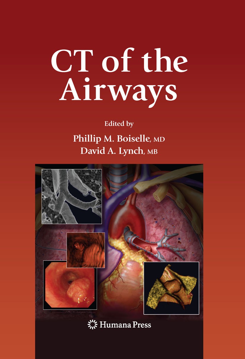 Titlebook: CT of the Airways; Phillip M. Boiselle,David A. Lynch Book 2008 The Editor(s) (if applicable) and The Author(s), under exclusive license t Titlebook: CT of the Airways; Phillip M. Boiselle,David A. Lynch Book 2008 The Editor(s) (if applicable) and The Author(s), under exclusive license t
